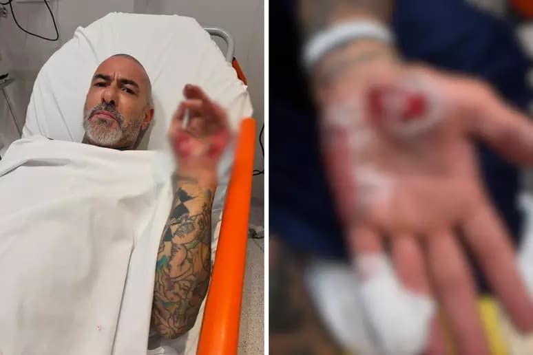 Henrique Fogaça relata acidente de moto e diz que teve aliança levada em hospital