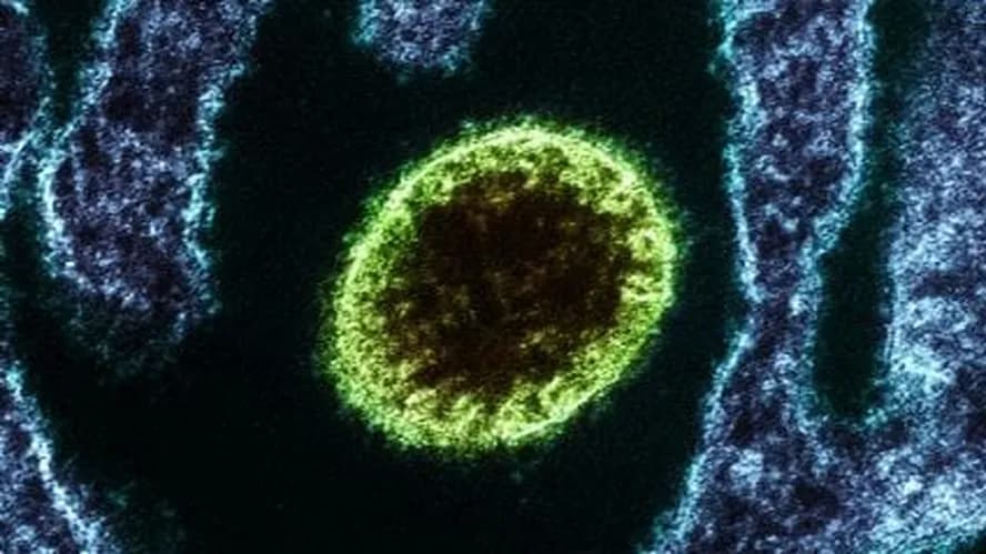 Vírus Nipah volta a acender alerta sanitário na Ásia por alta taxa de letalidade